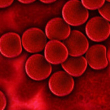 さくらひかりクリニック　内科部長　大上啓樹　血液中の赤血球細胞　白血球細胞　病理所見