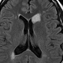 さくらひかりクリニック　内科部長　大上啓樹　頭部CT・MRI