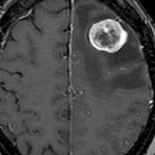 さくらひかりクリニック　内科部長　大上啓樹　頭部CT・MRI