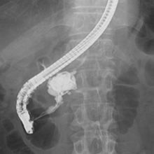 さくらひかりクリニック　内科部長　大上啓樹　ERCP