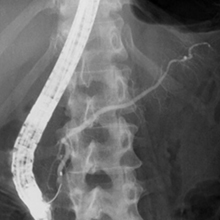 さくらひかりクリニック　内科部長　大上啓樹　ERCP